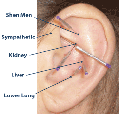 Ear Detox Points